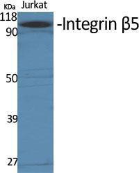 Western blot analysis of various cells using Anti-Integrin beta5 Antibody