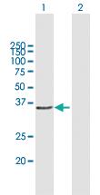 Anti-CCND1 Mouse Polyclonal Antibody