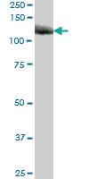 Anti-DPP4 Mouse Polyclonal Antibody