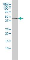 Anti-TES Mouse Monoclonal Antibody [clone: 1G11-B7]