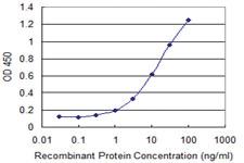 Anti-RAB22A Mouse Monoclonal Antibody [clone: 2B12]