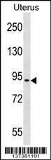 Anti-ASTE1 Rabbit Polyclonal Antibody (AP (Alkaline Phosphatase))