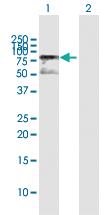 Anti-MECP2 Rabbit Polyclonal Antibody