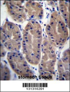 Anti-FRMD7 Rabbit Polyclonal Antibody