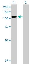 Anti-DPP4 Rabbit Polyclonal Antibody