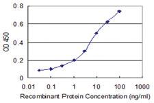 Anti-CACNA1I Mouse Monoclonal Antibody [clone: 2F5]