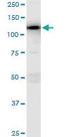 Anti-MAP3K13 Rabbit Polyclonal Antibody