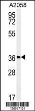 Anti-MFSD3 Rabbit Polyclonal Antibody (FITC (Fluorescein Isothiocyanate))