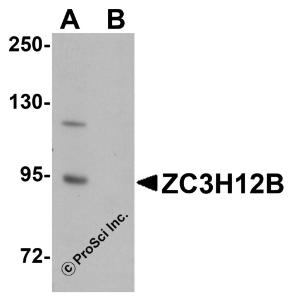 Western blot analysis of ZC3H12B in mouse brain tissue lysate with ZC3H12B antibody at 1 &#956;g/mL in (A) the absence and (B) the presence of blocking peptide.