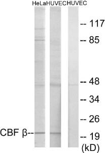 Western blot analysis of lysates from HUVEC and HeLa cells using Anti-CBF beta Antibody. The right hand lane represents a negative control, where the antibody is blocked by the immunising peptide