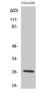 Western blot analysis of various cells using Anti-PRSS33 Antibody