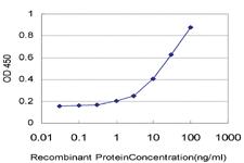 Anti-DPP4 Mouse Monoclonal Antibody [clone: 1C5]