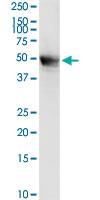 Anti-MECP2 Rabbit Polyclonal Antibody