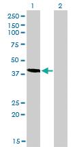 Anti-TES Mouse Monoclonal Antibody [clone: 1G11-B7]