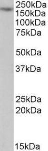 Anti-MYO5A Antibody (A82988) (1 µg/ml) staining of Jurkat lysate (35 µg protein in RIPA buffer). Primary incubation was 1 hour. Detected by chemiluminescence