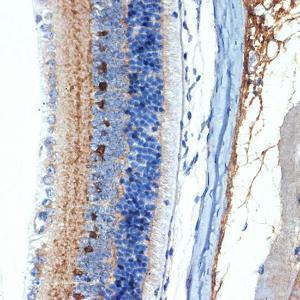 Immunohistochemistry analysis of paraffin-embedded mouse retina using Anti-CRABP1 Antibody [ARC1991] (A308999) at a dilution of 1:100 (40x lens) Perform microwave antigen retrieval with 10 mM Tris/EDTA buffer pH 90 before commencing with IHC staining protocol