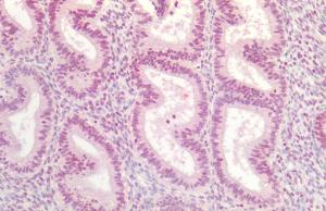 Immunohistochemistry analysis of human uterus, fixed in formalin and paraffin-embedded. The Primary Antibody used was Anti-AKT1 Antibody (A304932)