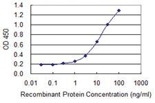 Anti-DPT Mouse Monoclonal Antibody [clone: 2A11]