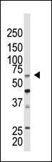 Anti-CBX4 Rabbit Polyclonal Antibody