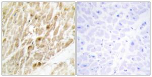 Immunohistochemical analysis of paraffin-embedded human heart tissue using Anti-CBF beta Antibody. The right hand panel represents a negative control, where the antibody was pre-incubated with the immunising peptide