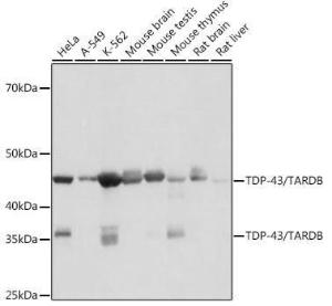 Western blot analysis of extracts of various cell lines, using Anti-TDP43 Antibody [ARC0492] (A306079) at 1:1,000 dilution. The secondary antibody was Goat Anti-Rabbit IgG H&L Antibody (HRP) at 1:10,000 dilution.