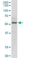 Anti-MECP2 Rabbit Polyclonal Antibody