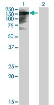 Anti-tim Mouse Polyclonal Antibody