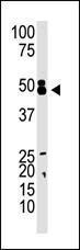 Anti-CBX8 Rabbit Polyclonal Antibody (AP (Alkaline Phosphatase))