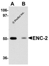 Western blot analysis of ENC-2 in Jurkat cell lysate with ENC-2 antibody at 1 &#956;g/mL in (A) the absence and (B) the presence of blocking peptide.