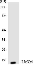 Western blot analysis of the lysates from HepG2 cells using Anti-LMO4 Antibody