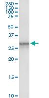 Anti-KLK10 Rabbit Polyclonal Antibody