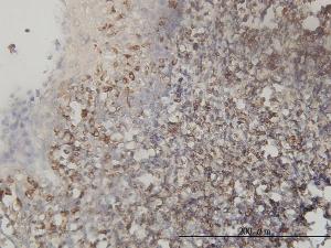 Anti-TES Mouse Monoclonal Antibody [clone: 1G11-B7]