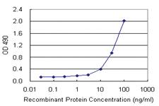 Anti-ADH5 Polyclonal Antibody Pair