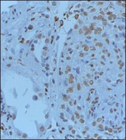 Anti-GREM1 Rabbit Polyclonal Antibody (AP (Alkaline Phosphatase))