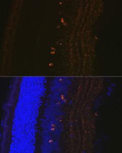 Immunofluorescence analysis of rat eye using Anti-CRABP1 Antibody [ARC1991] (A308999) at a dilution of 1:100 (40x lens) DAPI was used to stain the cell nuclei (blue)