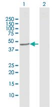 Anti-CYP20A1 Rabbit Polyclonal Antibody