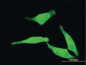 Anti-NT5C2 Mouse Monoclonal Antibody [clone: 3C1]