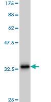 Anti-SCGB3A2 Mouse Monoclonal Antibody [clone: 1B2]