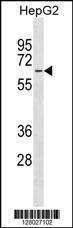 Anti-MFSD4 Rabbit Polyclonal Antibody (APC (Allophycocyanin))