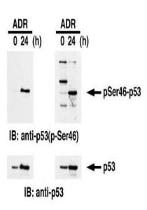 Anti-p53 (phospho Ser46) Antibod