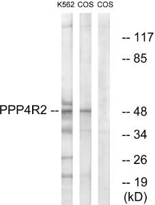 Western blot analysis of lysates from K562 and COS7 cells using Anti-PPP4R2 Antibody. The right hand lane represents a negative control, where the antibody is blocked by the immunising peptide