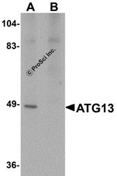 Western blot analysis of ATG13 in rat heart tissue lysate with ATG13 antibody at 1 &#956;g/mL in (A) the absence and (B) the presence of blocking peptide.