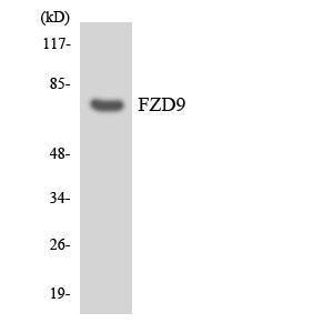 Western blot analysis of the lysates from Jurkat cells using Anti-FZD9 Antibody