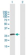 Anti-SPC25 Mouse Polyclonal Antibody