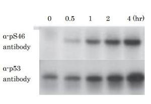 Anti-p53 (phospho Ser46) Antibod