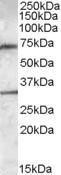 Anti-LIPG Antibody (A84603) (0.3µg/ml) staining of Human Liver lysate (35µg protein in RIPA buffer). Primary incubation was 1 hour. Detected by chemiluminescence.