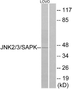 Western blot analysis of lysates from LOVO cells using Anti-SAPK Antibody. The right hand lane represents a negative control, where the antibody is blocked by the immunising peptide.