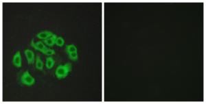 Anti-Mucin-14 antibody