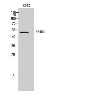 Western blot analysis of K562 cells using Anti-PPP4R2 Antibody