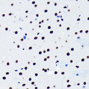 Immunohistochemistry analysis of paraffin-embedded mouse brain using Anti-TDP43 Antibody [ARC0492] (A306079) at a dilution of 1:100 (40x lens). Perform microwave antigen retrieval with 10 mM PBS buffer pH 7.2 before commencing with IHC staining protocol.